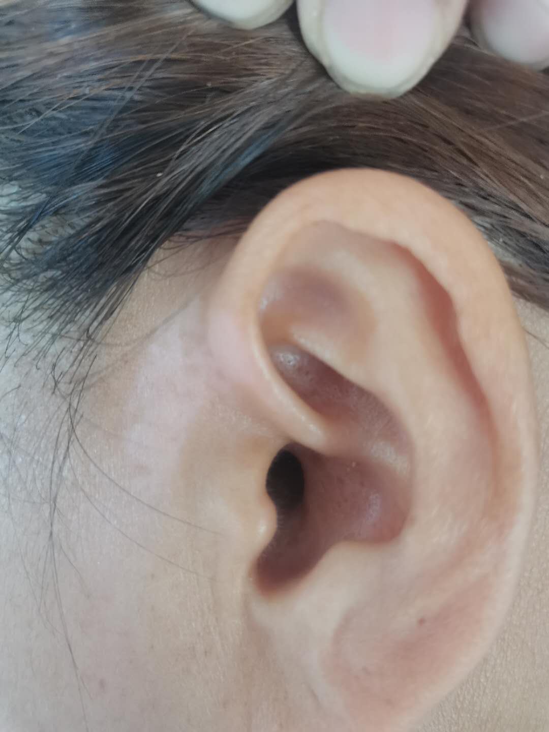 Case progress photo