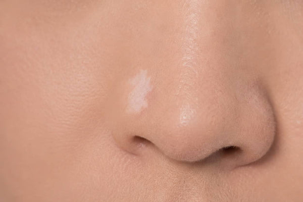 Nose