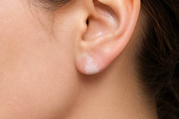 Ears