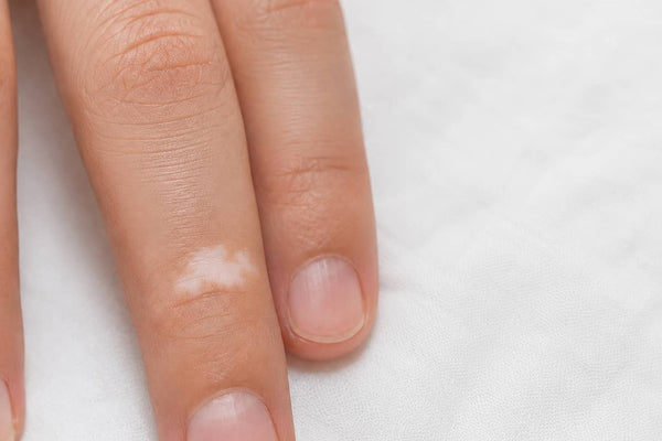Fingertips