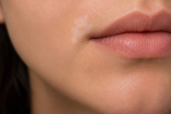 Lips