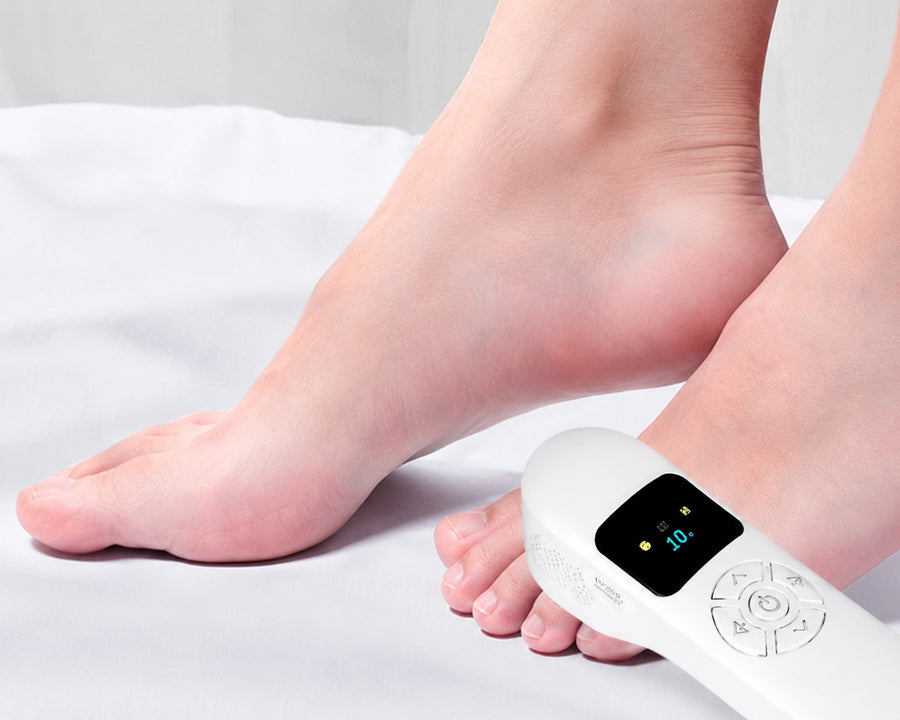 UV308B application example on toes
