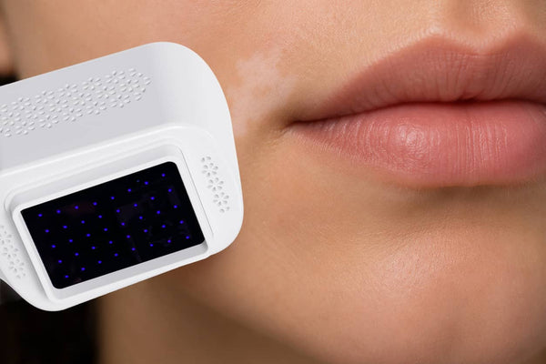 Lips