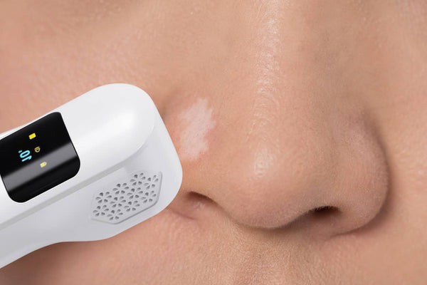 Nose