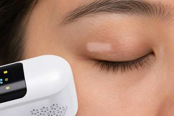 Eyelids