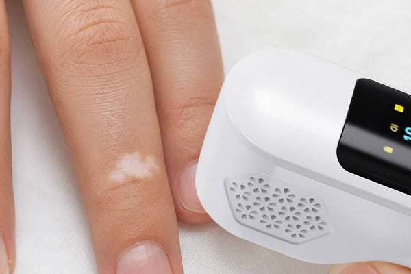 Fingertips