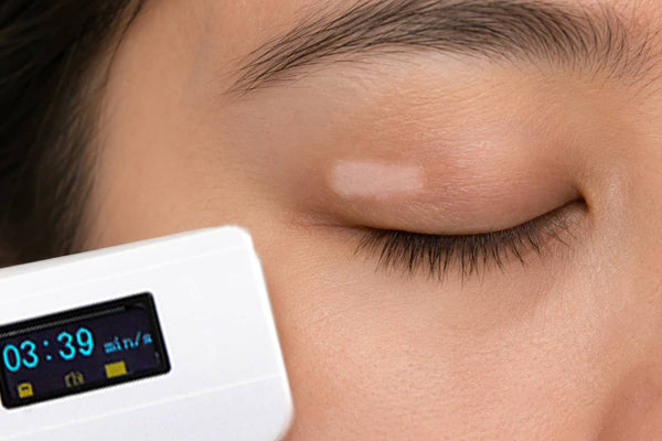 Eyelids