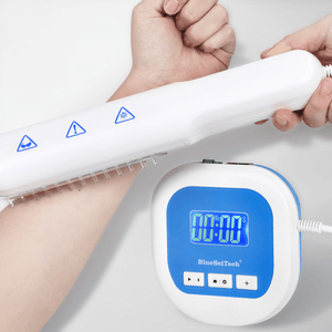 BU-1 Handheld UVB Phototherapy Lamp Timer | 311nm Narrow Band | YOUWEMED