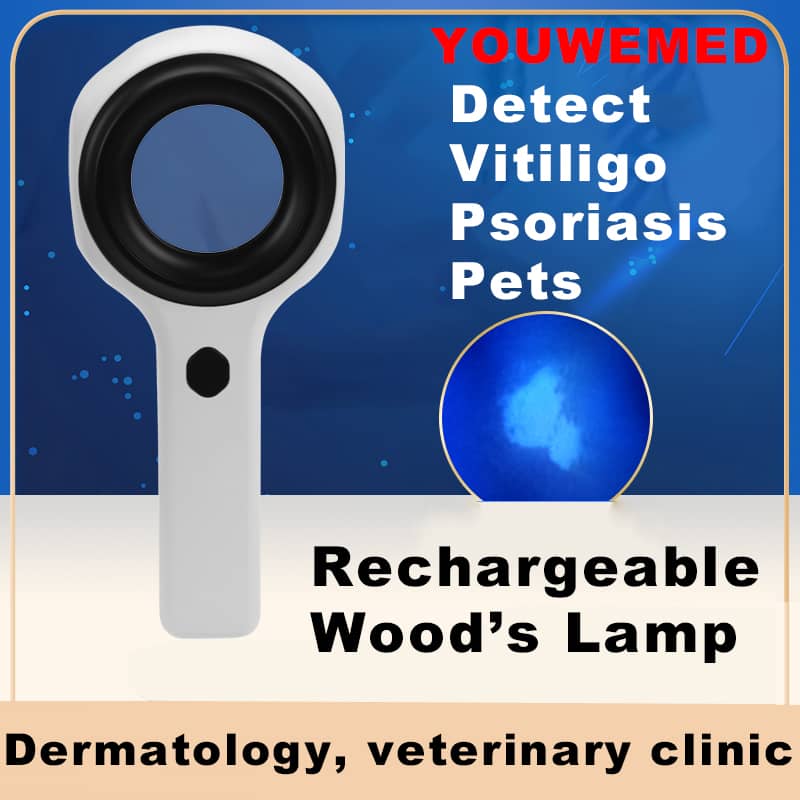 BZ-5L Wood's Lamp | YOUWEMED