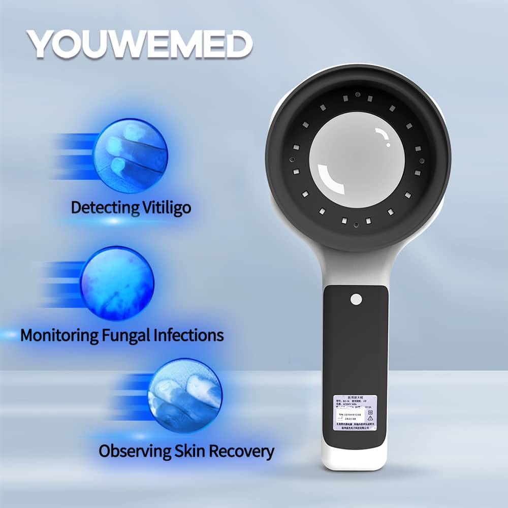 BZ-5L Wood's Lamp | YOUWEMED