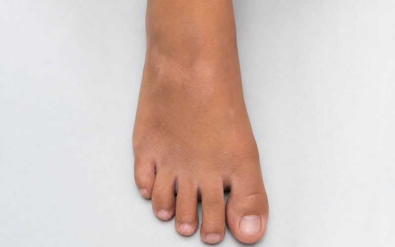 After treatment