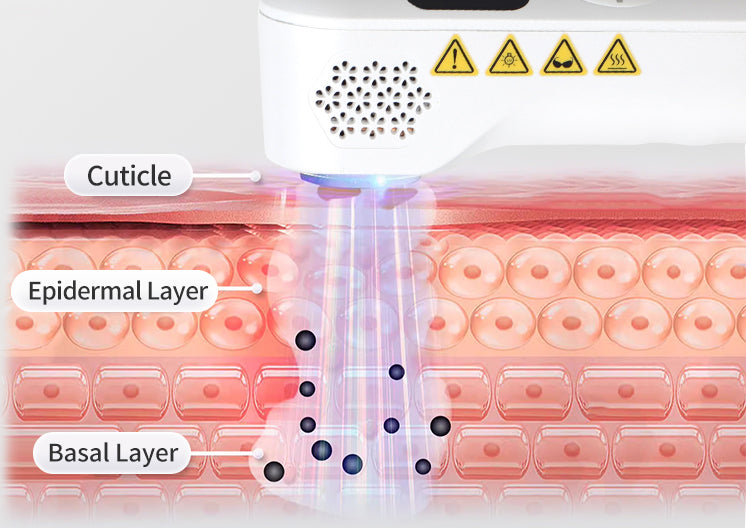 Simplified illustration of 308nm UVB directed toward the outer layers of skin